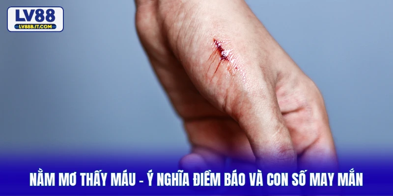 Nằm Mơ Thấy Máu - Ý Nghĩa Điềm Báo Và Con Số May Mắn